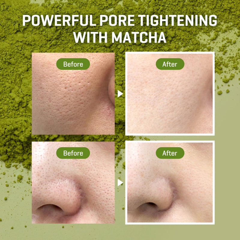 SOMEBYMI SUPER MATCHA PORE CARE STARTER KIT