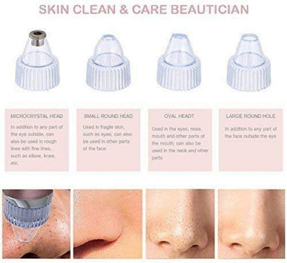 Pore Cleaning Device - 5-in-1 USB Rechargeable Blackhead Remover Vacuum