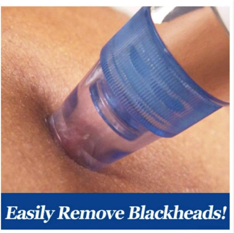 Pore Cleaning Device - 5-in-1 USB Rechargeable Blackhead Remover Vacuum